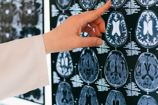Intelligente Patientenakten