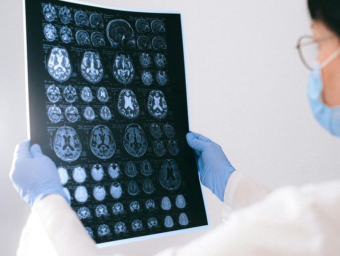 Radiologie mit KI-Unterstützung